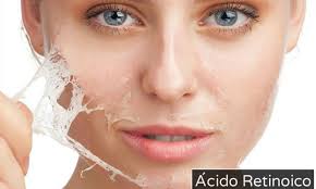 acido retinoico